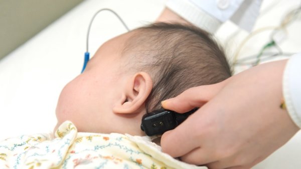 股票配资行情 沪上专家牵头制定全球首个婴儿前庭筛查国际共识